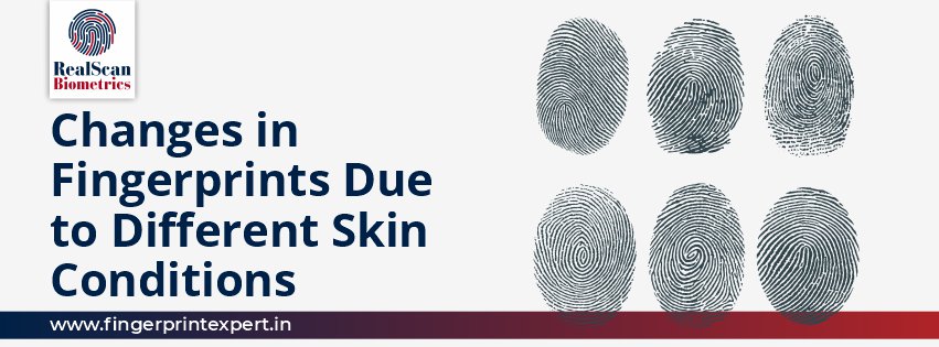 Changes in Fingerprints Due to Different Skin Conditions